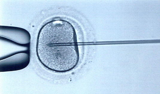 Fertilizzazione in vitro